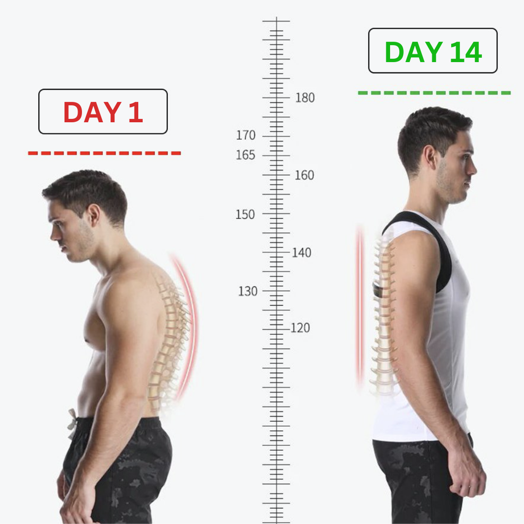The Posture Corrector™